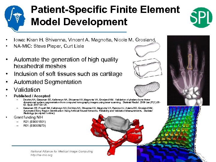 Patient-Specific Finite Element Model Development • • Iowa: Kiran H. Shivanna, Vincent A. Magnotta,