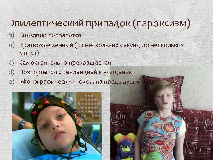 Эпилептический припадок (пароксизм) a) Внезапно появляется b) Кратковременный (от нескольких секунд до нескольких минут)