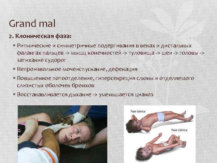 Grand mal 2. Клоническая фаза: § Ритмические и симметричные подергивания в веках и дистальных