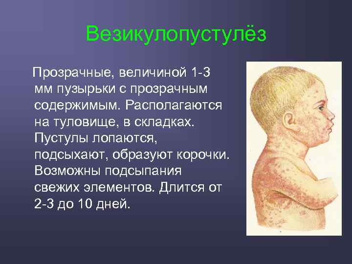 Везикулопустулёз Прозрачные, величиной 1 -3 мм пузырьки с прозрачным содержимым. Располагаются на туловище, в
