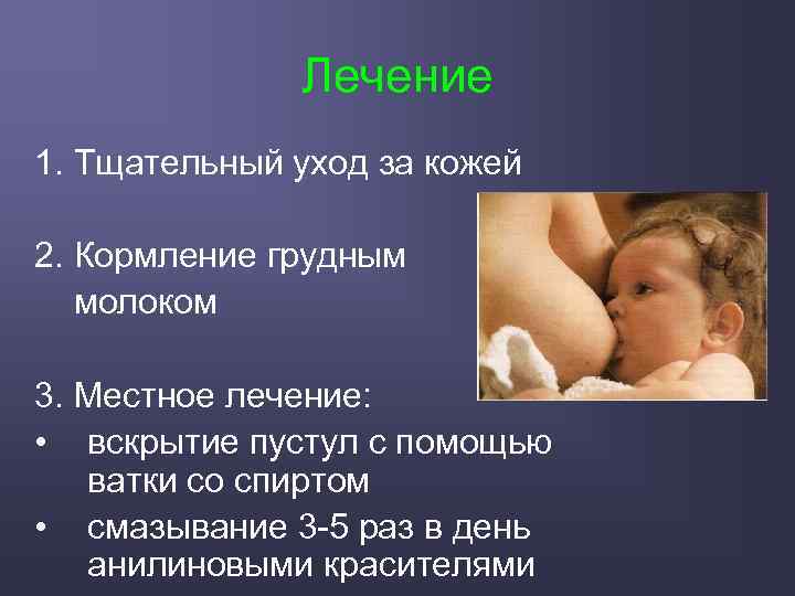 Лечение 1. Тщательный уход за кожей 2. Кормление грудным молоком 3. Местное лечение: •