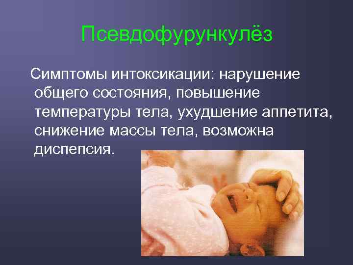 Псевдофурункулёз Симптомы интоксикации: нарушение общего состояния, повышение температуры тела, ухудшение аппетита, снижение массы тела,