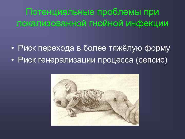 Потенциальные проблемы при локализованной гнойной инфекции • Риск перехода в более тяжёлую форму •
