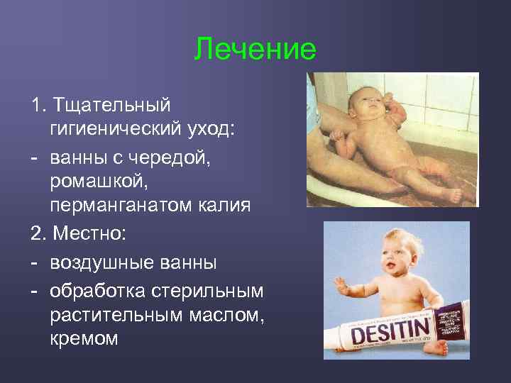 Лечение 1. Тщательный гигиенический уход: - ванны с чередой, ромашкой, перманганатом калия 2. Местно: