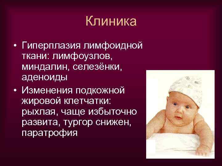 Клиника • Гиперплазия лимфоидной ткани: лимфоузлов, миндалин, селезёнки, аденоиды • Изменения подкожной жировой клетчатки: