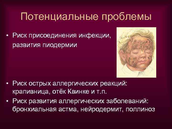 Потенциальные проблемы • Риск присоединения инфекции, развития пиодермии • Риск острых аллергических реакций: крапивница,