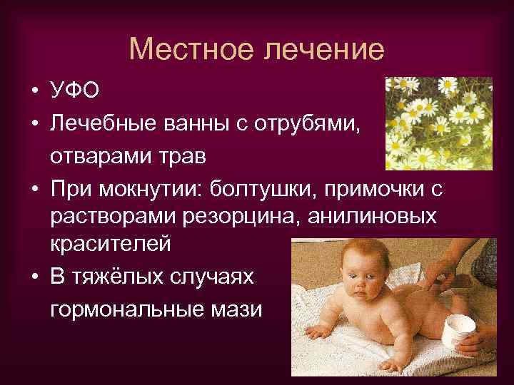 Местное лечение • УФО • Лечебные ванны с отрубями, отварами трав • При мокнутии: