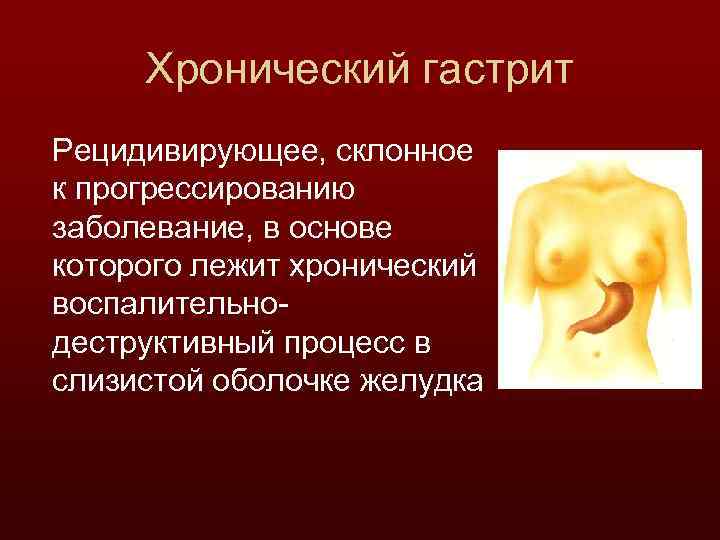 Хронический гастрит Рецидивирующее, склонное к прогрессированию заболевание, в основе которого лежит хронический воспалительнодеструктивный процесс