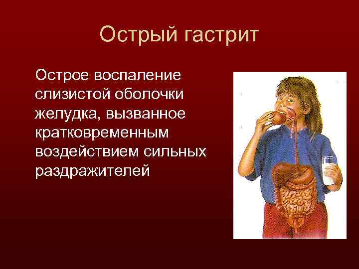 Острый гастрит Острое воспаление слизистой оболочки желудка, вызванное кратковременным воздействием сильных раздражителей 