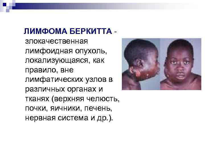 ЛИМФОМА БЕРКИТТА злокачественная лимфоидная опухоль, локализующаяся, как правило, вне лимфатических узлов в различных органах