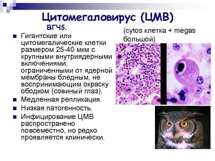 Цитомегаловирус (ЦМВ) n n ВГЧ 5. Гигантские или цитомегалические клетки размером 25 -40 мкм