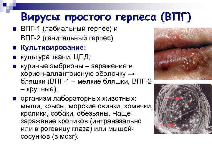 Вирусы простого герпеса (ВПГ) n n n ВПГ-1 (лабиальный герпес) и ВПГ-2 (генитальный герпес).