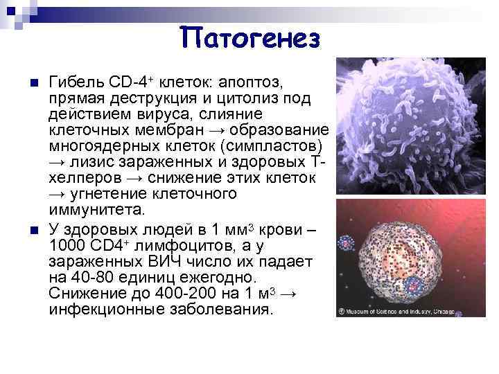 Патогенез n n Гибель CD-4+ клеток: апоптоз, прямая деструкция и цитолиз под действием вируса,