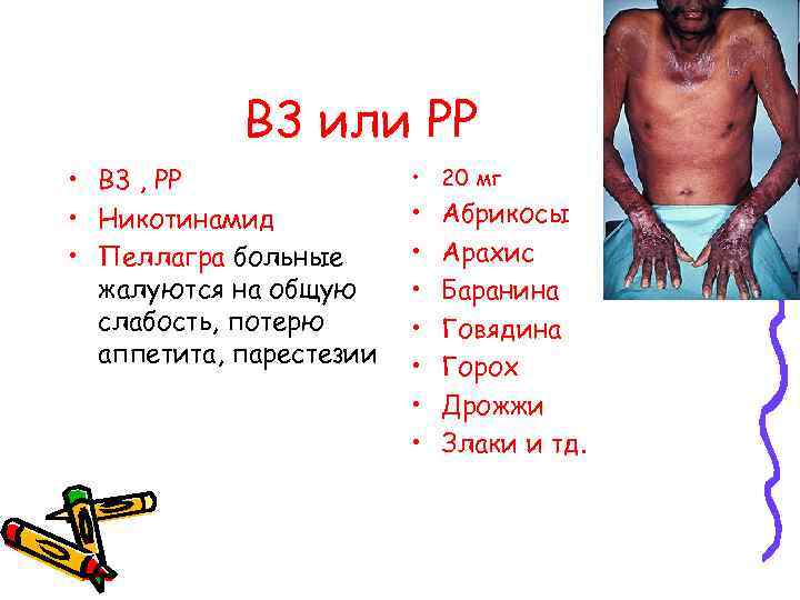 В 3 или РР • B 3 , PP • Никотинамид • Пеллагра больные
