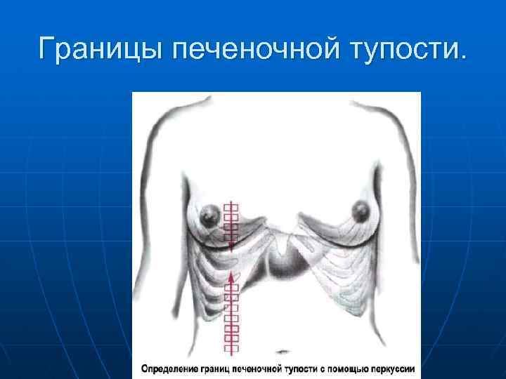Границы печеночной тупости. 