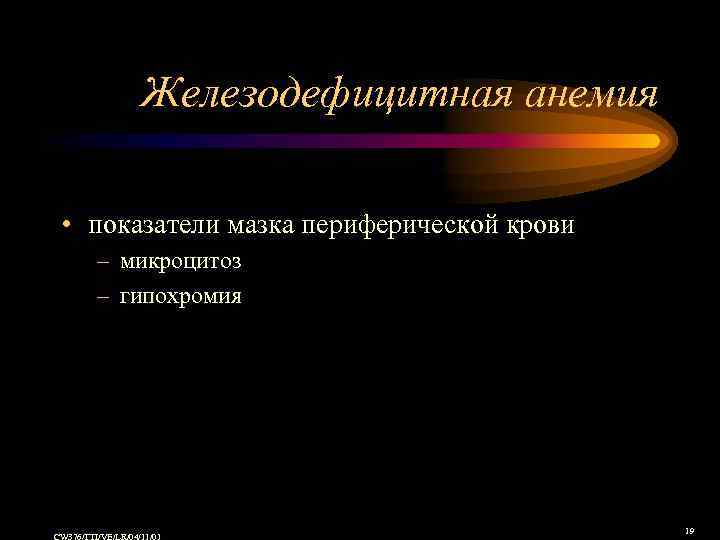 Железодефицитная анемия • показатели мазка периферической крови – микроцитоз – гипохромия 19 