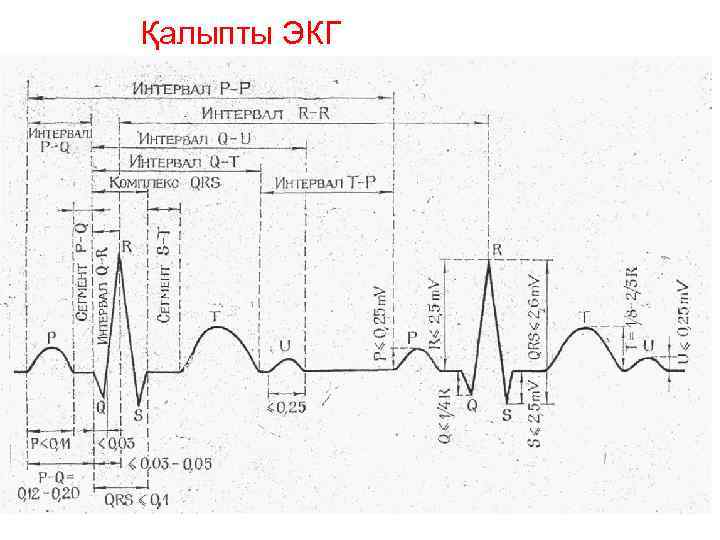 Қалыпты ЭКГ 
