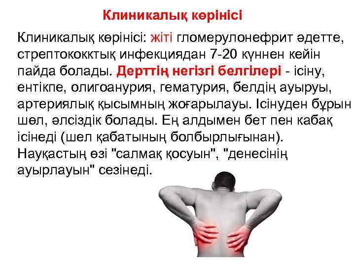 Клиникалық көрінісі: жіті гломерулонефрит әдетте, стрептококктық инфекциядан 7 -20 күннен кейін пайда болады. Дерттің