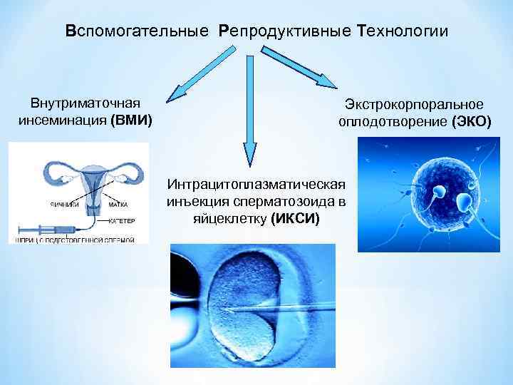 Вспомогательные Репродуктивные Технологии Внутриматочная инсеминация (ВМИ) Экстрокорпоральное оплодотворение (ЭКО) Интрацитоплазматическая инъекция сперматозоида в яйцеклетку