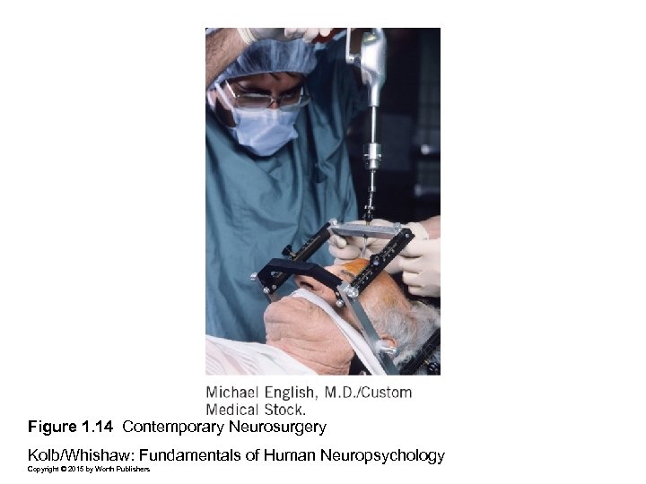 Figure 1. 14 Contemporary Neurosurgery Kolb/Whishaw: Fundamentals of Human Neuropsychology Copyright © 2015 by