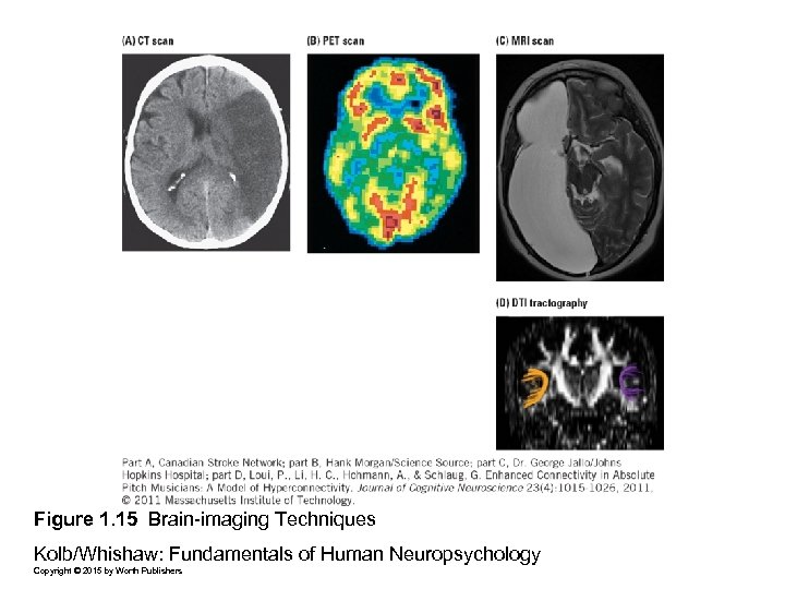 Figure 1. 15 Brain-imaging Techniques Kolb/Whishaw: Fundamentals of Human Neuropsychology Copyright © 2015 by