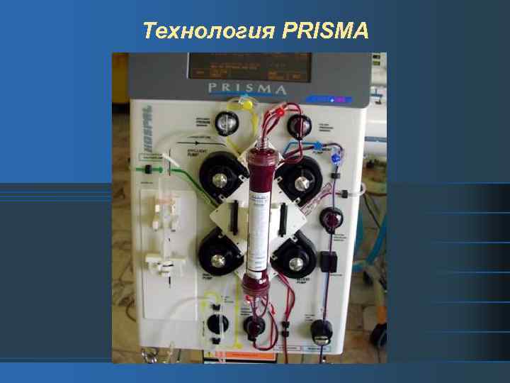 Технология PRISMA 