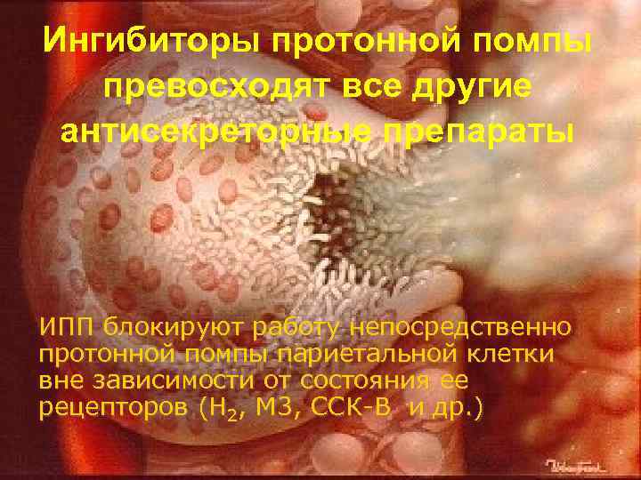 Ингибиторы протонной помпы превосходят все другие антисекреторные препараты ИПП блокируют работу непосредственно протонной помпы