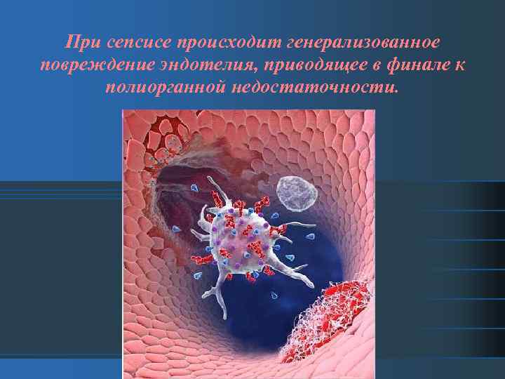 При сепсисе происходит генерализованное повреждение эндотелия, приводящее в финале к полиорганной недостаточности. 