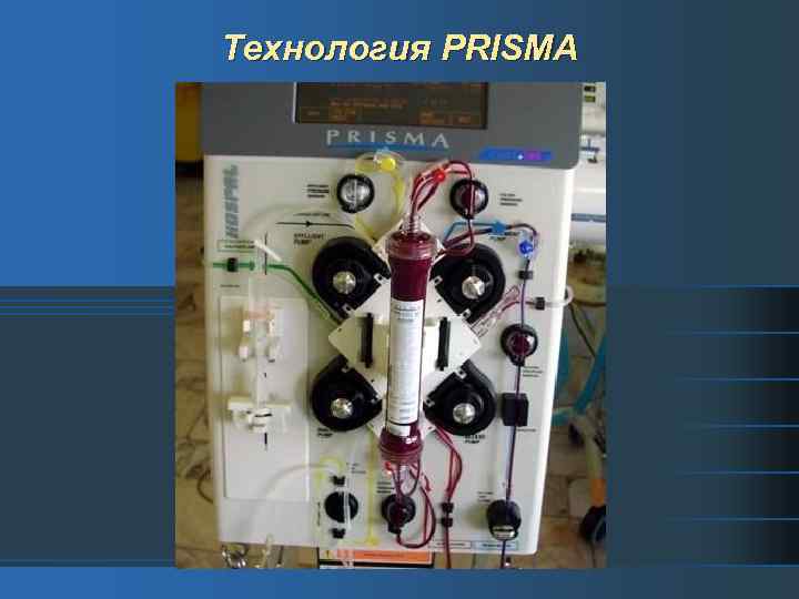 Технология PRISMA 