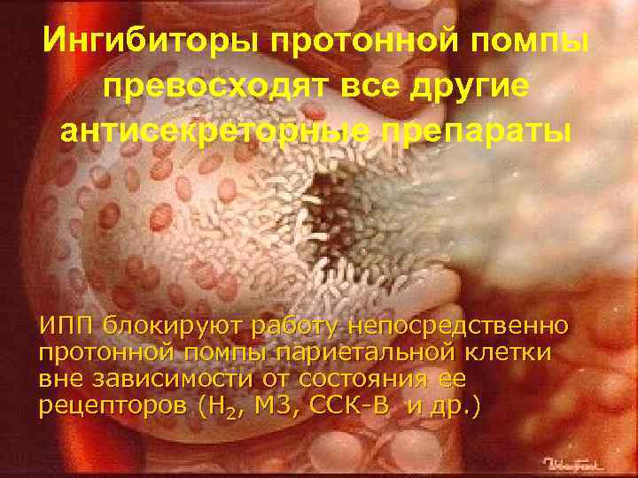 Ингибиторы протонной помпы превосходят все другие антисекреторные препараты ИПП блокируют работу непосредственно протонной помпы