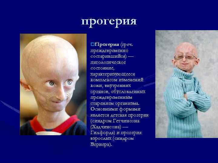 прогерия o. Прогерия (греч. преждевременно состарившийся) — патологическое состояние, характеризующееся комплексом изменений кожи, внутренних