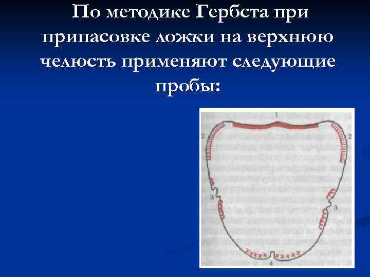 Припасовка индивидуальной ложки на верхней челюсти проводят по следующему плану