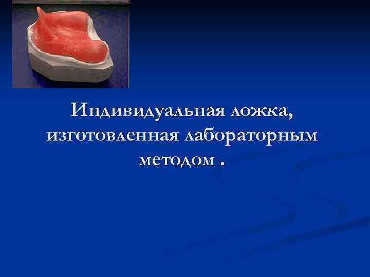 Припасовка индивидуальной ложки на верхней челюсти проводят по следующему плану