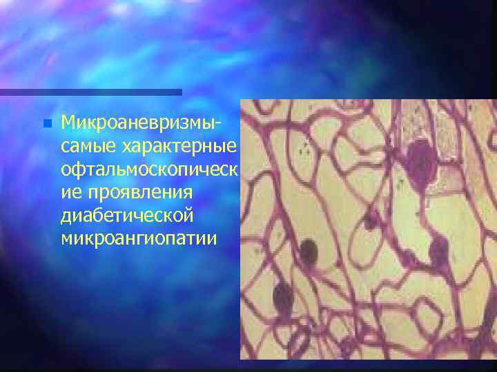 n Микроаневризмысамые характерные офтальмоскопическ ие проявления диабетической микроангиопатии n 