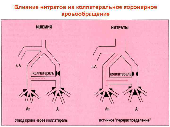 Влияние нитратов на коллатеральное коронарное кровообращение 