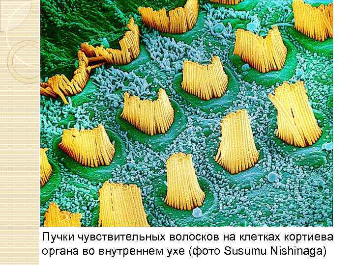 Пучки чувствительных волосков на клетках кортиева органа во внутреннем ухе (фото Susumu Nishinaga) 