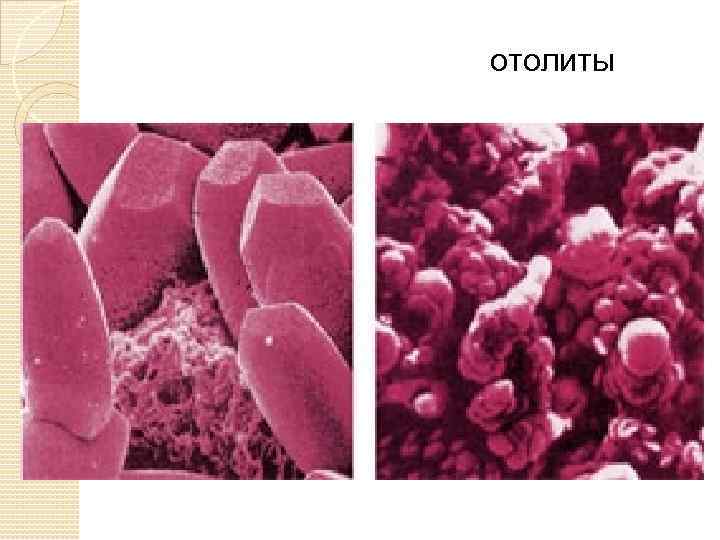 отолиты 