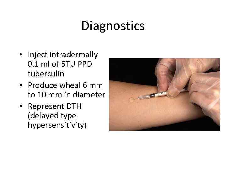 Diagnostics • Inject intradermally 0. 1 ml of 5 TU PPD tuberculin • Produce