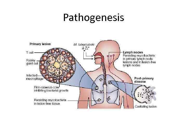 Pathogenesis 