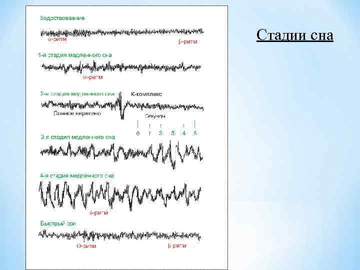 Стадии сна 