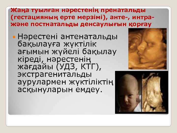 Жаңа туылған нәрестенің пренатальды (гестацияның ерте мерзімі), анте-, интражәне постнатальды денсаулығын қорғау Нәрестені антенатальды