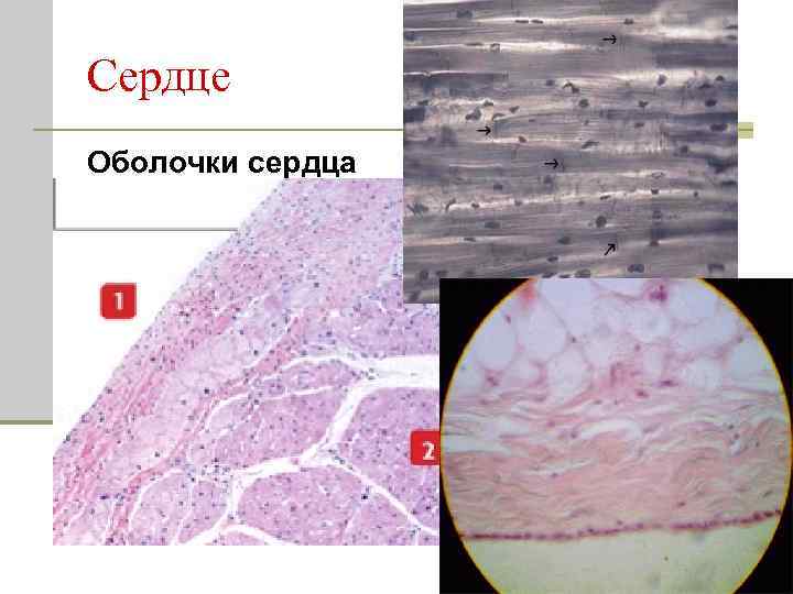 Сердце Оболочки сердца 