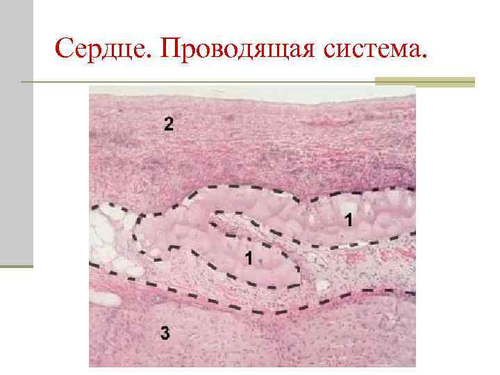 Сердце. Проводящая система. 