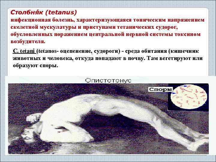 Столбня к (tetanus) инфекционная болезнь, характеризующаяся тоническим напряжением скелетной мускулатуры и приступами тетанических судорог,