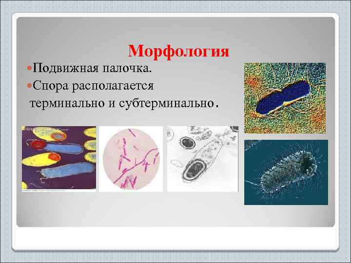  Подвижная Морфология палочка. Спора располагается терминально и субтерминально. 
