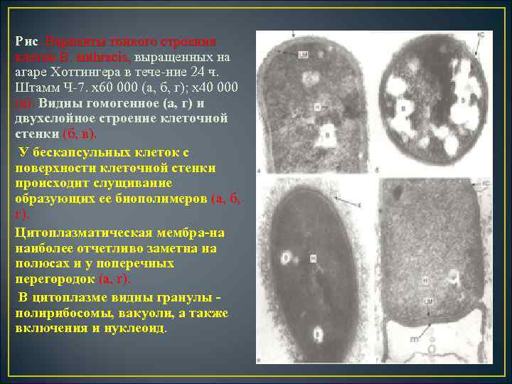 Рис. Варианты тонкого строения клеток В. anthracis, выращенных на клеток В. anthracis, агаре Хоттингера