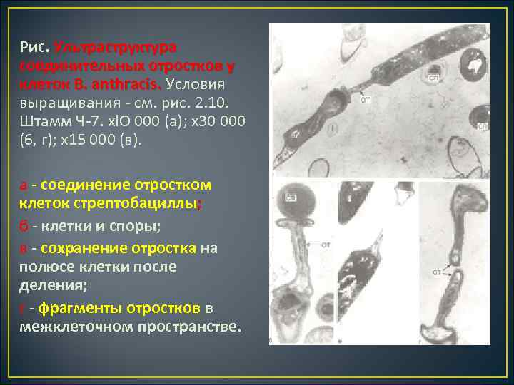 Рис. Ультраструктура соединительных отростков у клеток В. anthracis. Условия клеток В. anthracis. выращивания см.