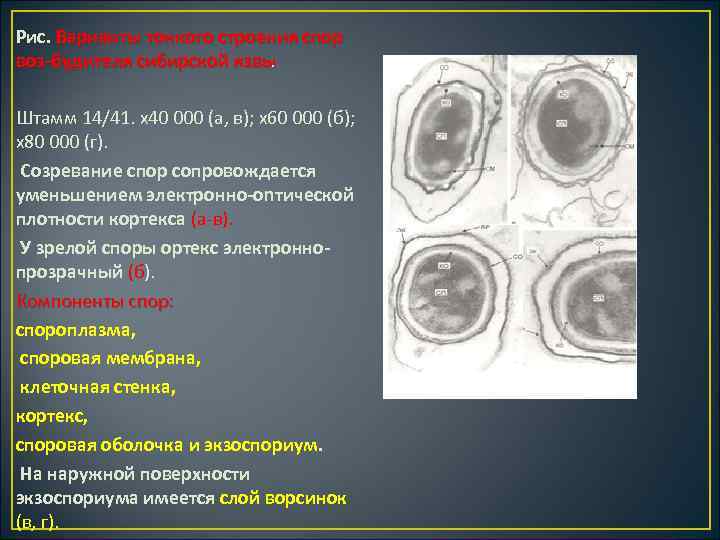 Рис. Варианты тонкого строения спор воз будителя сибирской язвы. Штамм 14/41. х40 000 (а,