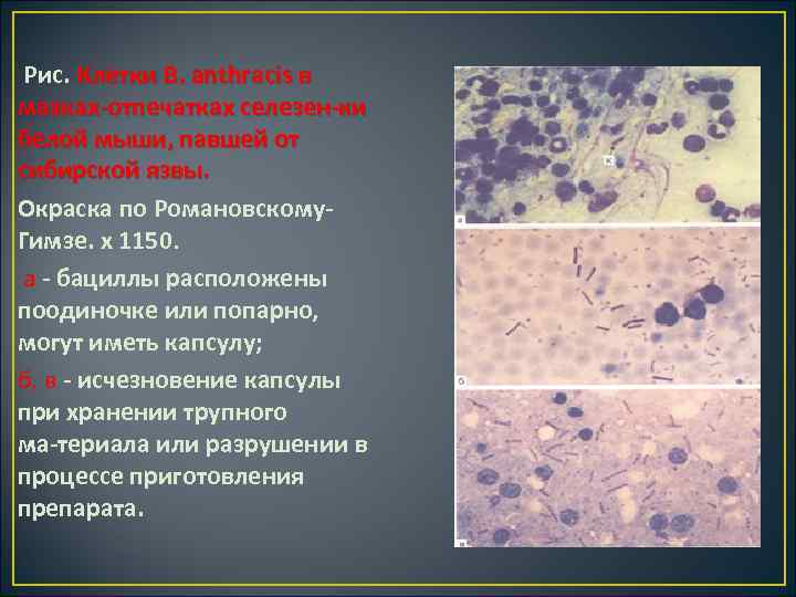  Рис. Клетки В. anthracis в мазках отпечатках селезен ки белой мыши, павшей от