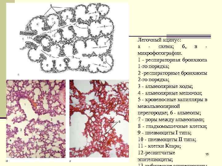 Легочный ацинус: а - схема; б, в - микрофотографии. 1 - респираторная бронхиола 1